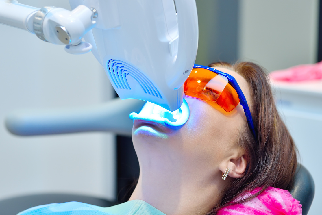 Teeth Whitening for Patient Woman.